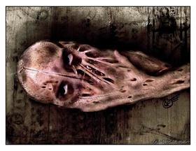 Dissected Thoughts Revisited 2