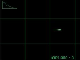 Herat Rate - Flatlined