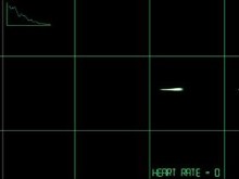 Herat Rate - Flatlined